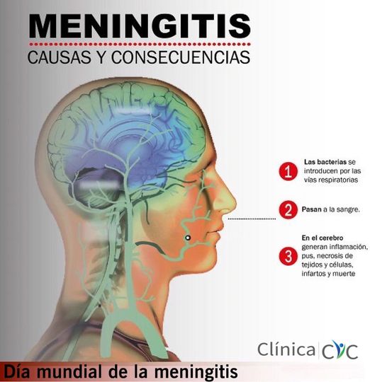 Día mundial de la Meningitis
